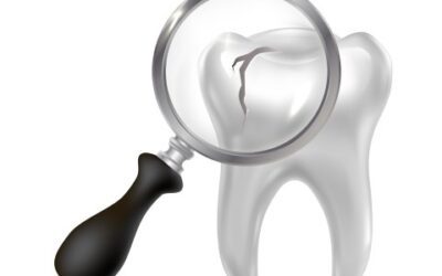 Materiales Dentales Biocompatibles en la Odontología Biológica